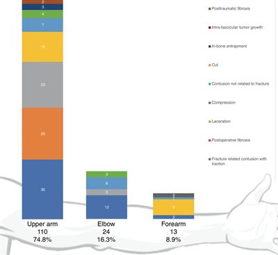 Etiological and epidemiological characteristics of surgically treated radial nerve lesions: A 20-year single-center experience